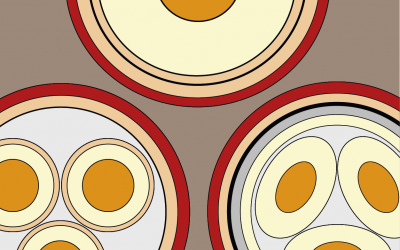 Doorsnede diverse kabels